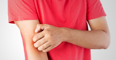 Eczema and gut health – the hidden link